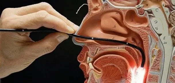 Modelo anatômico em corte sagital mostrando o trajeto do endoscópio flexível pelo nariz e faringe durante a avaliação das vias aéreas